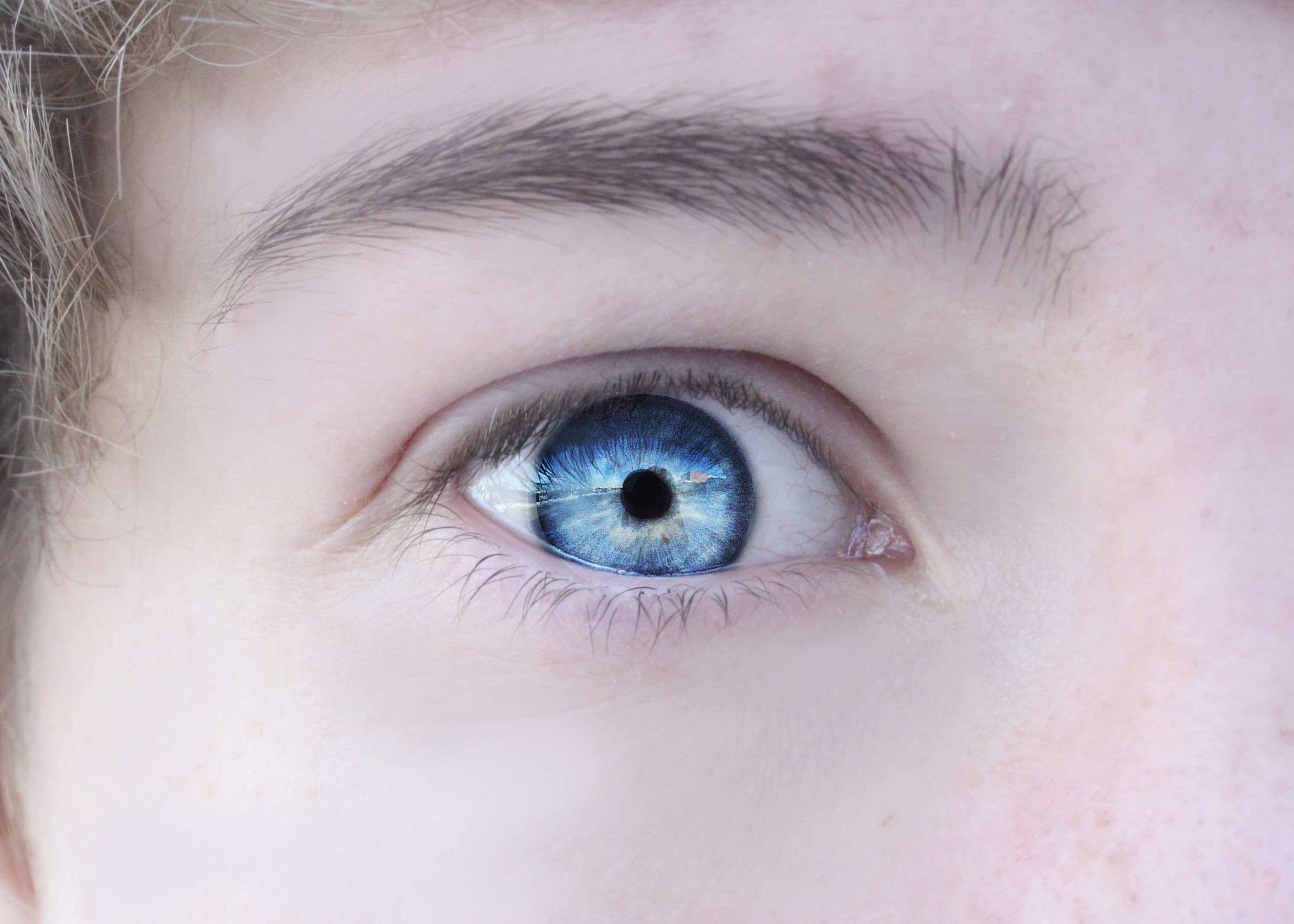 ice blue colored eyes